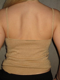 GOLD TOP